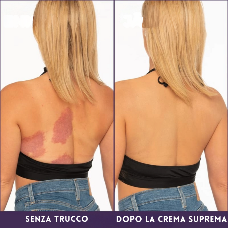 Crema Suprema Tutto-in-Uno